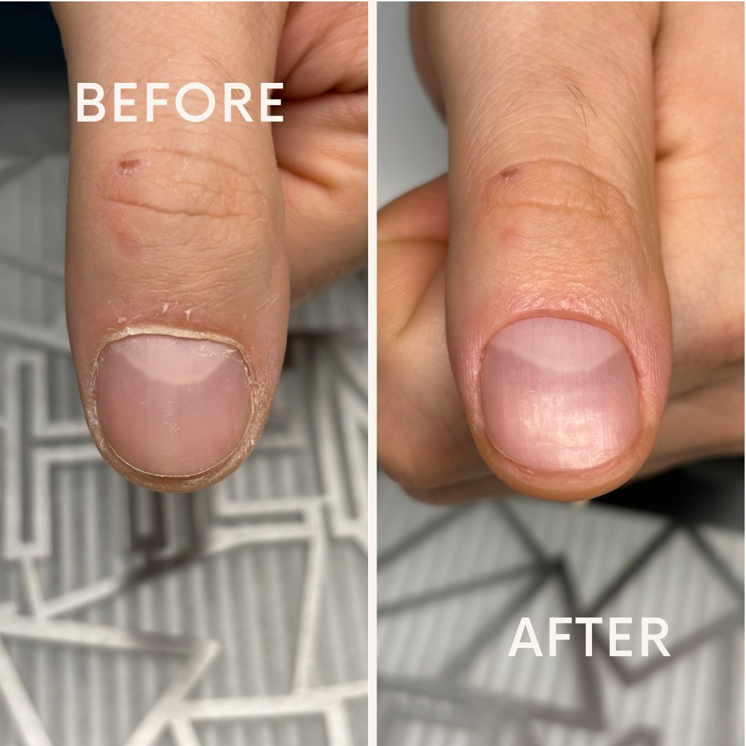 Hygienic manicure (before and after)