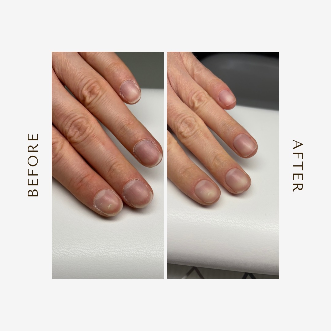 Hygienic manicure (before and after)